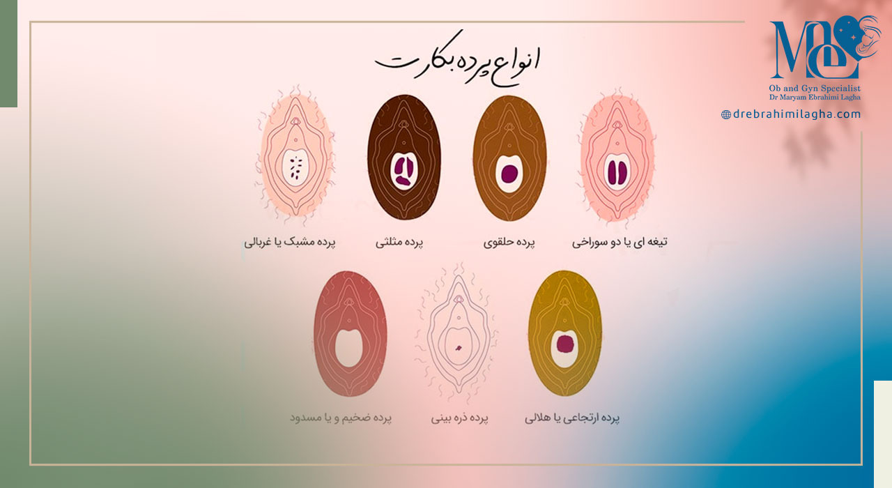 همه چیز در مورد پرده بکارت