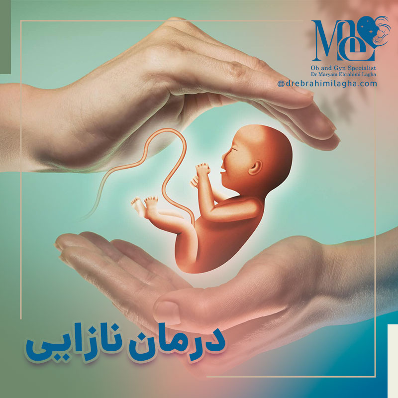 درمان نازایی در زنان