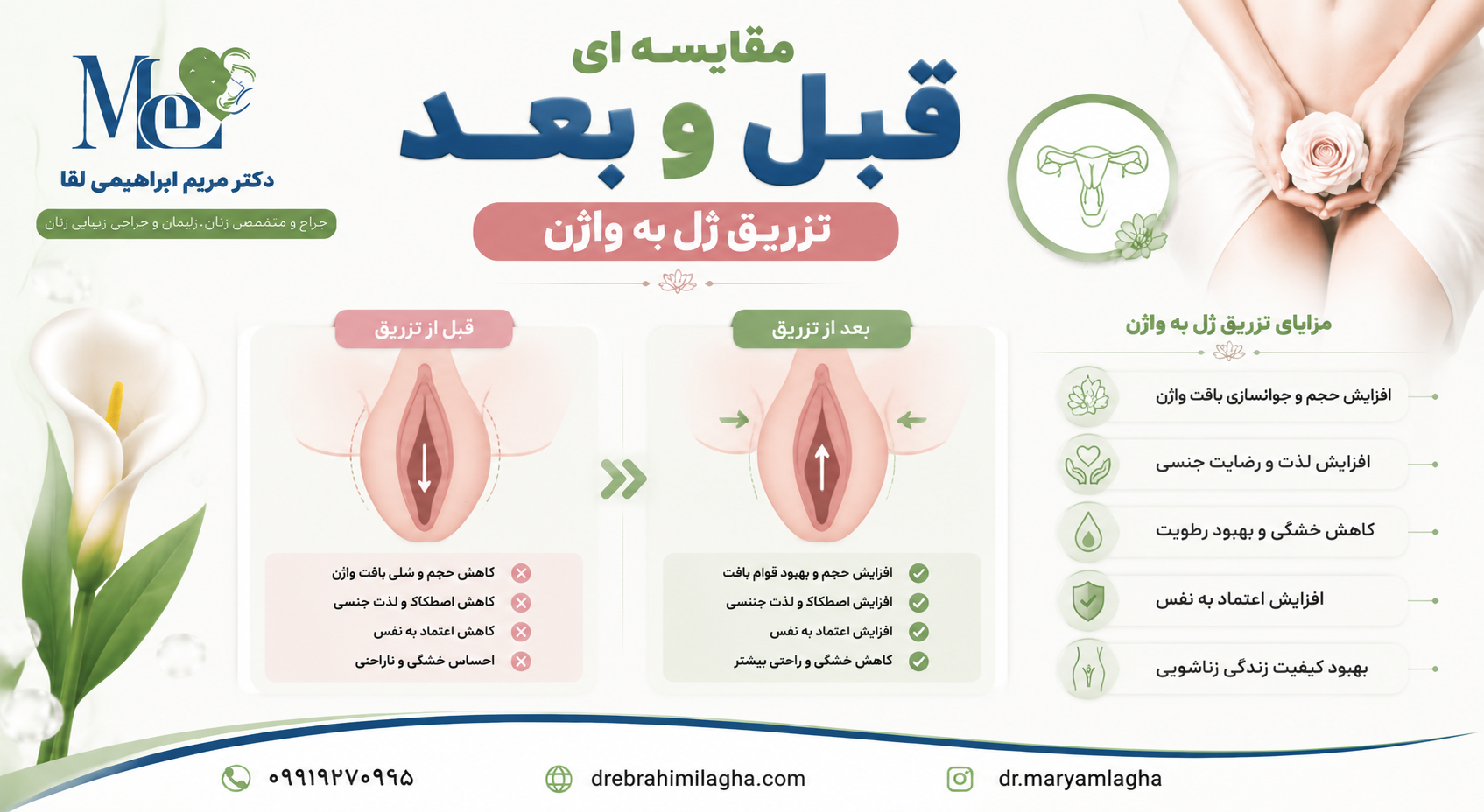 کاربردهای تزریق ژل به واژن